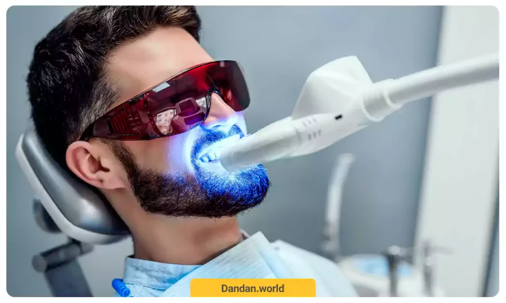 بلیچینگ دندان در کلینیک دندانپزشکی