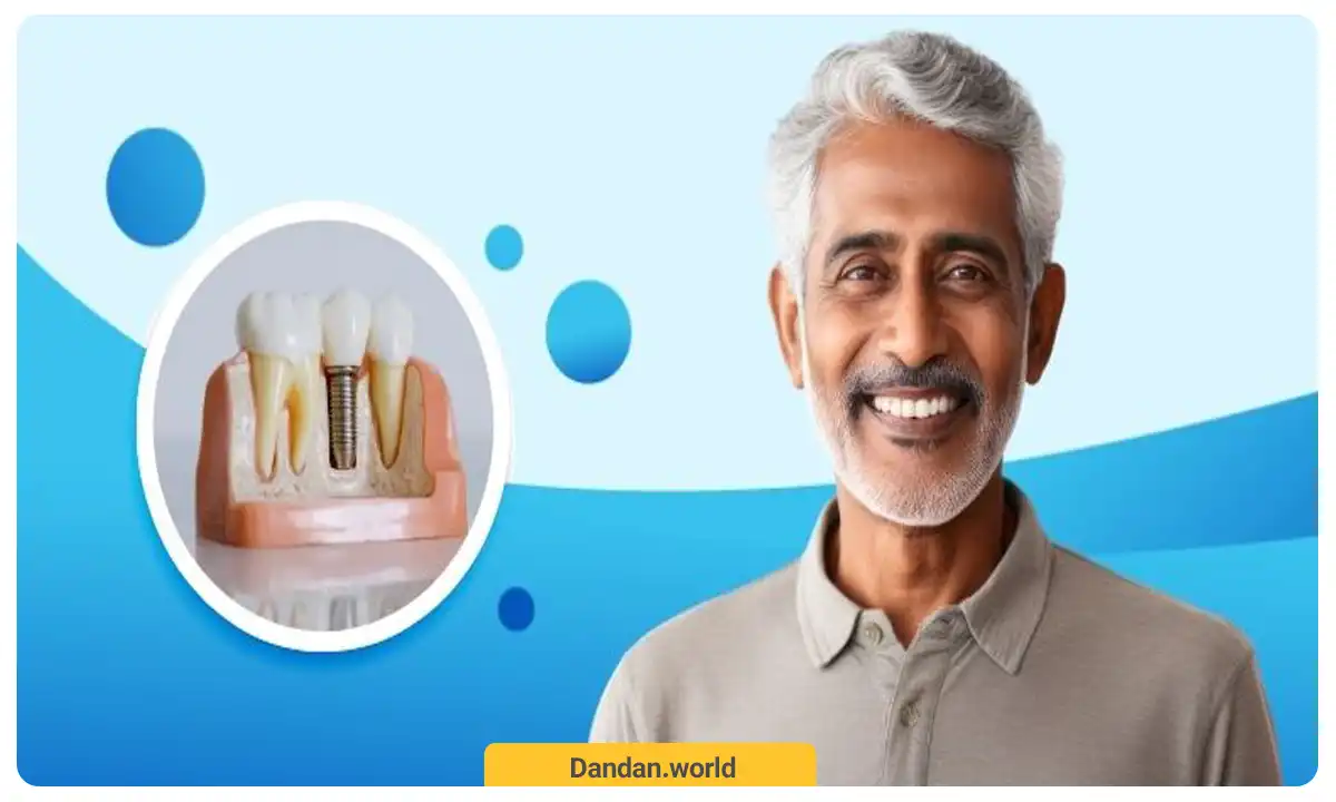 لبخند طبیعی با داشتن ایمپلنت دندان