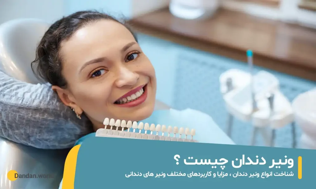 ونیر دندان