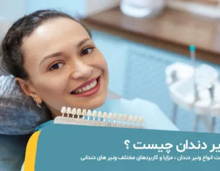 ونیر دندان