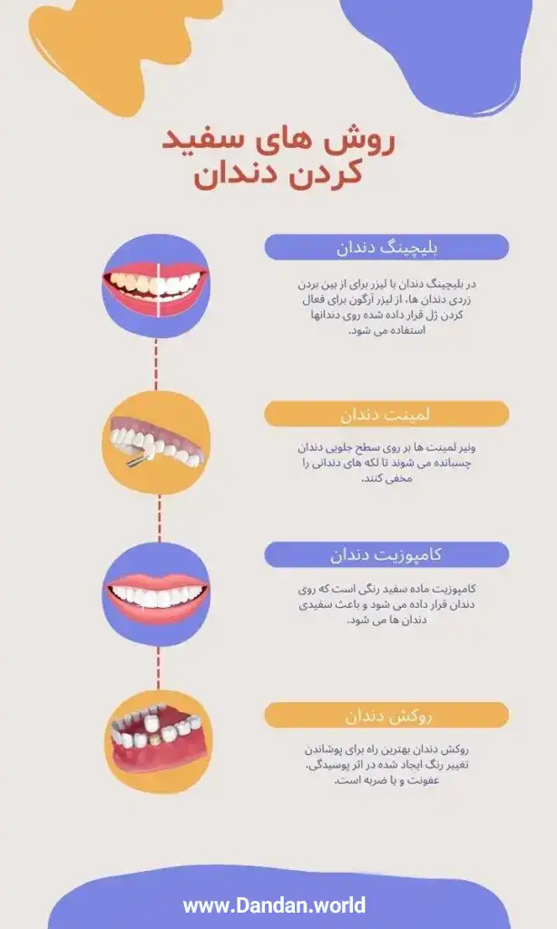 روش های سفید کردن دندان