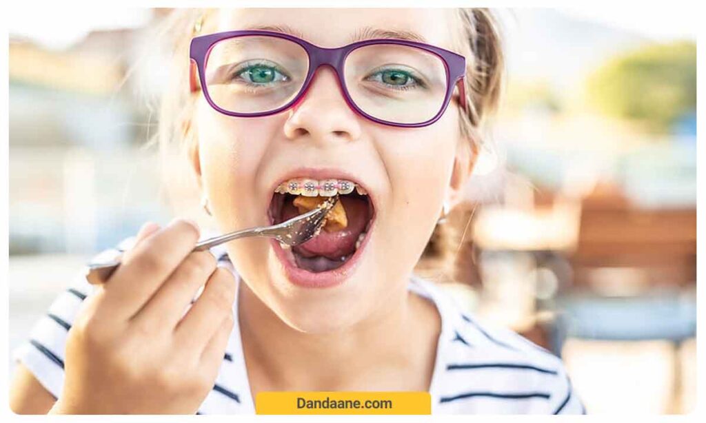 چگونه هزینه ارتودنسی کودکان را کاهش دهیم