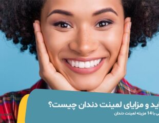 مزایای لمینت دندان