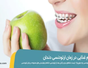 بعد از ارتودنسی چه بخوریم