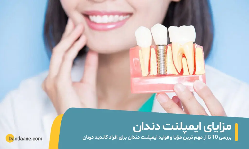 مزایای ایمپلنت دندان