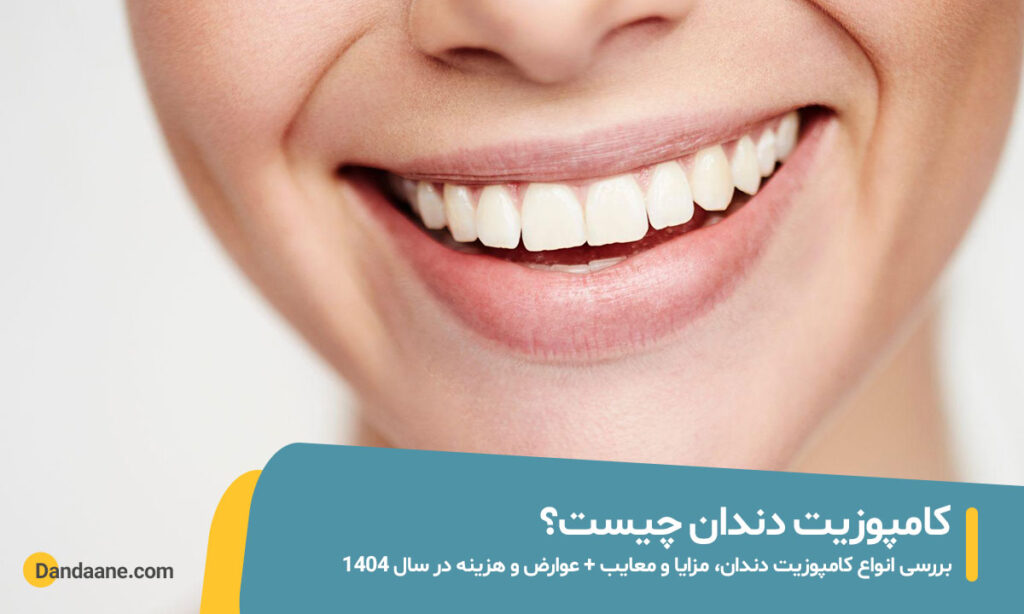 کامپوزیت دندان