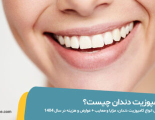 کامپوزیت دندان