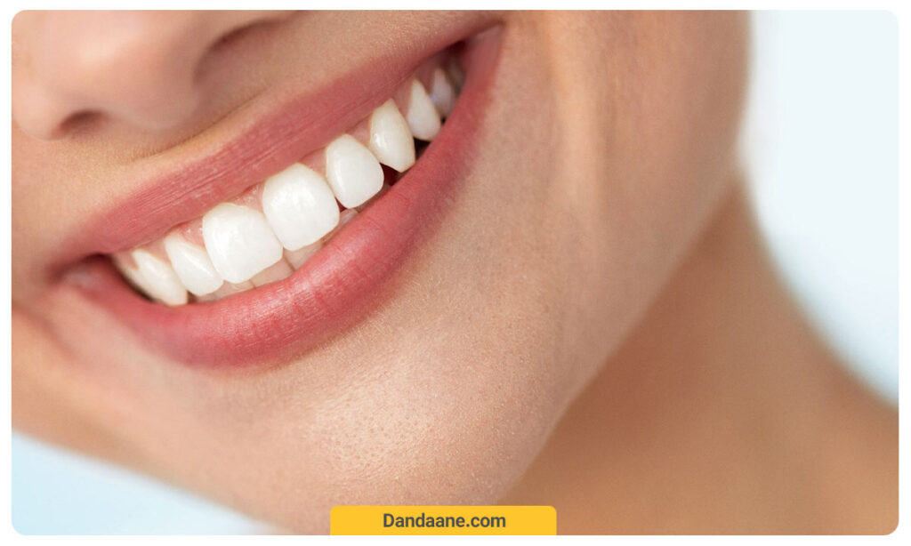 عکس لمینت کامپوزیتی