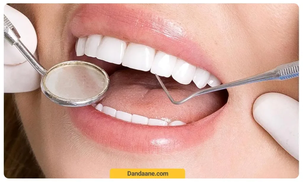 دندانپزشک در حال بررسی لمینت دندان 