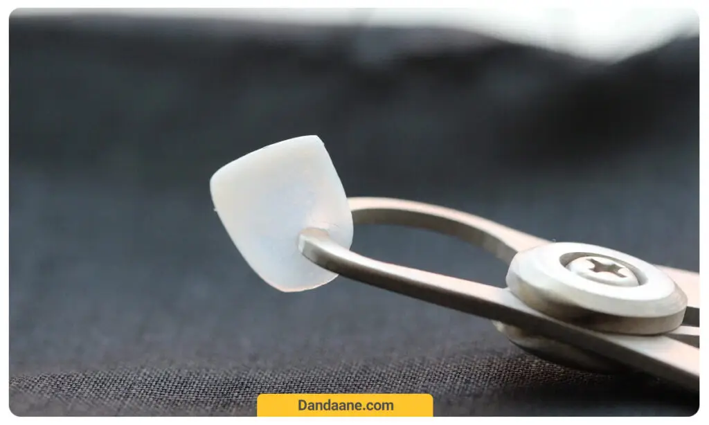 تصویر روکش لمینت دندان 