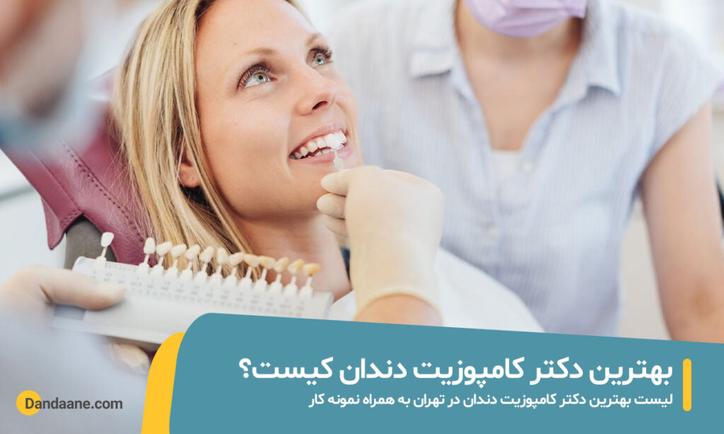 بهترین دکتر کامپوزیت دندان