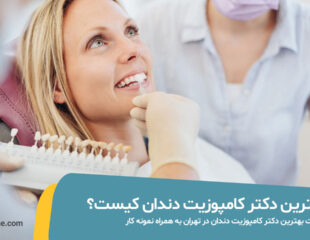 بهترین دکتر کامپوزیت دندان