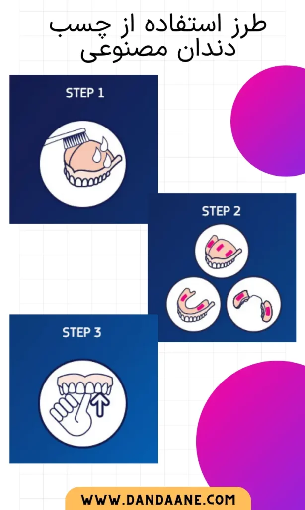 اینفوگرافی طرز استفاده از چسب دندان مصنوعی