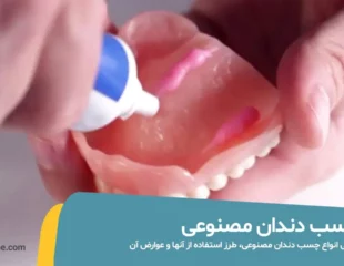 چسب دندان مصنوعی