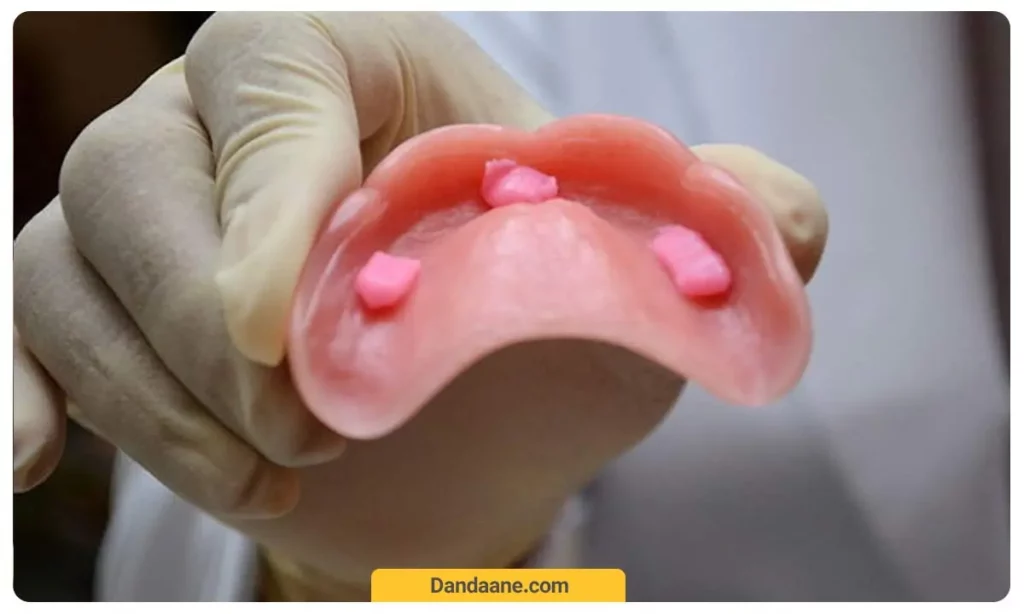 چسب دندان مصنوعی خمیری