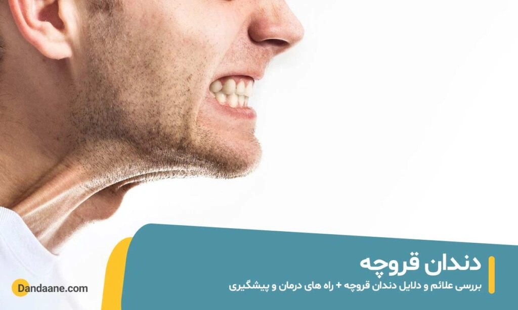 دندان قروچه