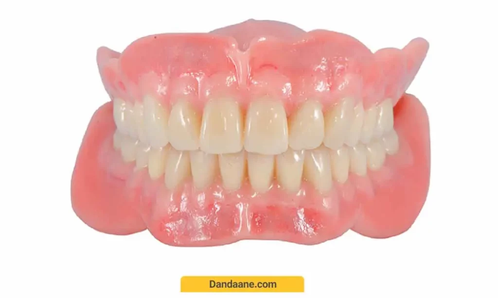 دندان مصنوعی آکریلیکی