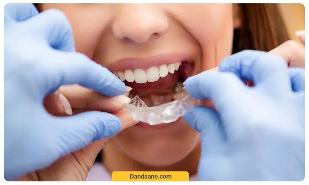 ارتودنسی با پلاک‌های شفاف