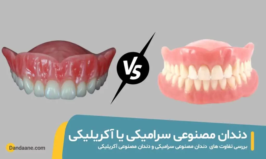 دندان مصنوعی سرامیکی بهتر است یا آکریلیکی