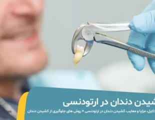 کشیدن دندان