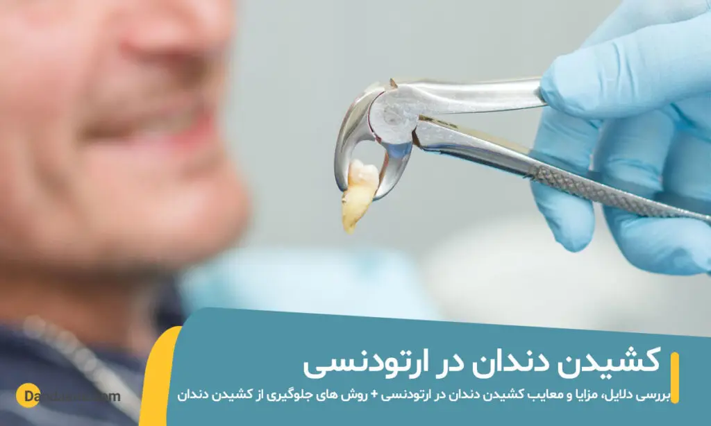 کشیدن دندان