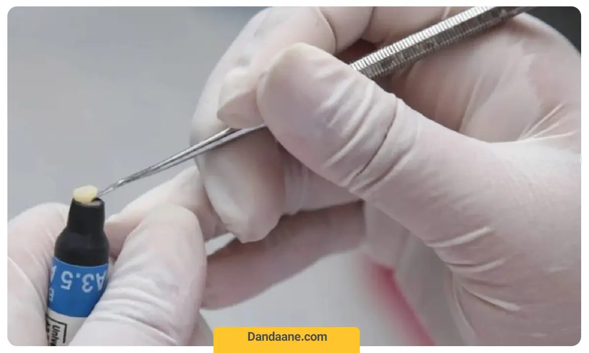 موادگذاری کامپوزیت دندان