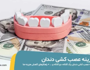 هزینه عصب کشی دندان