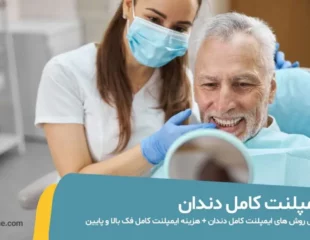 ایمپلنت کامل دندان