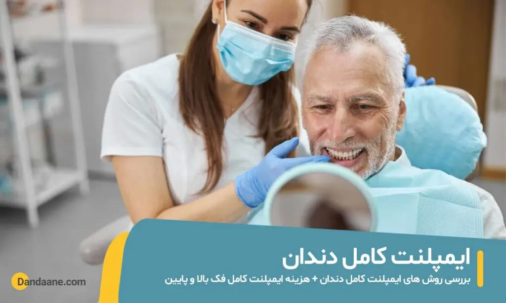ایمپلنت کامل دندان