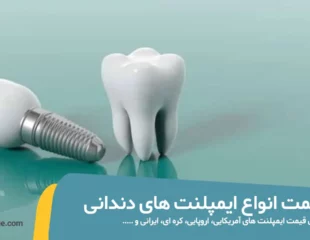 شاخص هزینه و قیمت ایمپلنت دندان