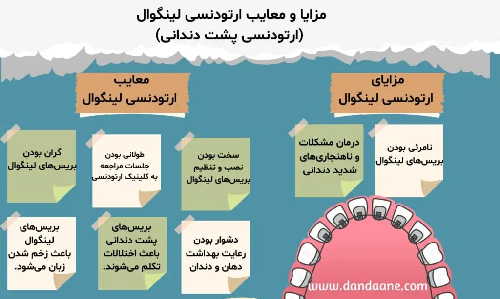 مزایا و معایب ارتودنسی لینگوال 