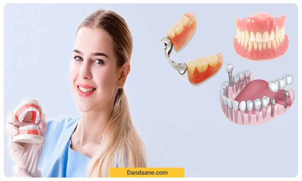 استفاده از دندان مصنوعی برای افراد جوان به جای ایمپلنت