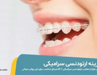 هزینه ارتودنسی سرامیکی