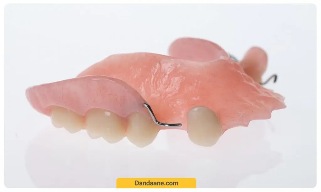 دندان مصنوعی پارسیل ترکیبی از فلز و پلاستیک برای یک فک
