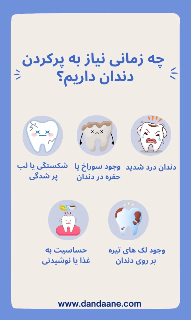 چه زمانی نیاز به پر کردن دندان داریم ؟