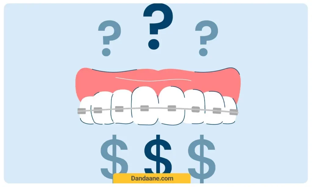 تصویر شماتیک از عوامل تاثیر گذار بر هزینه ارتودنسی دندان