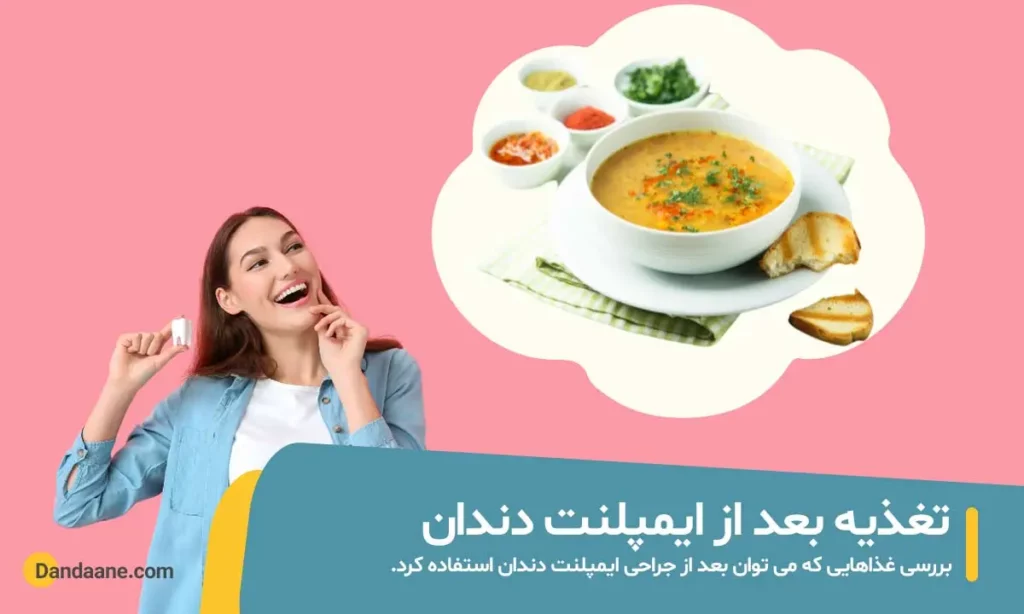 تغذیه بعد از ایمپلنت دندان