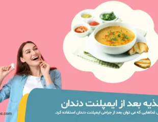 تغذیه بعد از ایمپلنت دندان