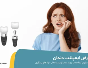 عوارض ایمپلنت دندان