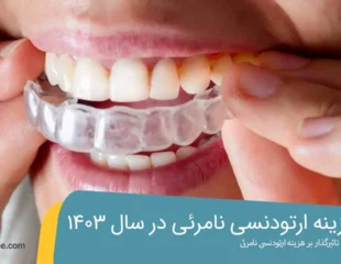 هزینه ارتودنسی نامرئی در سال 1403