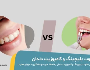 تفاوت بلیچینگ و کامپوزیت دندان