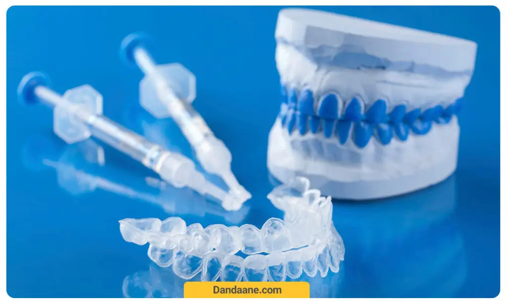 بلیچینگ یکی دیگر از راهکارهای سفید کردن دندان بعد از ارتودنسی است.
