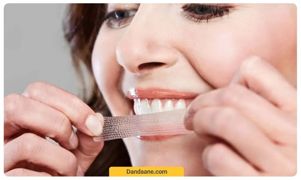 برای سفید کردن دندان ها بعد از ارتودنسی می توانید از قلم سفید کننده دندان استفاده کنید.