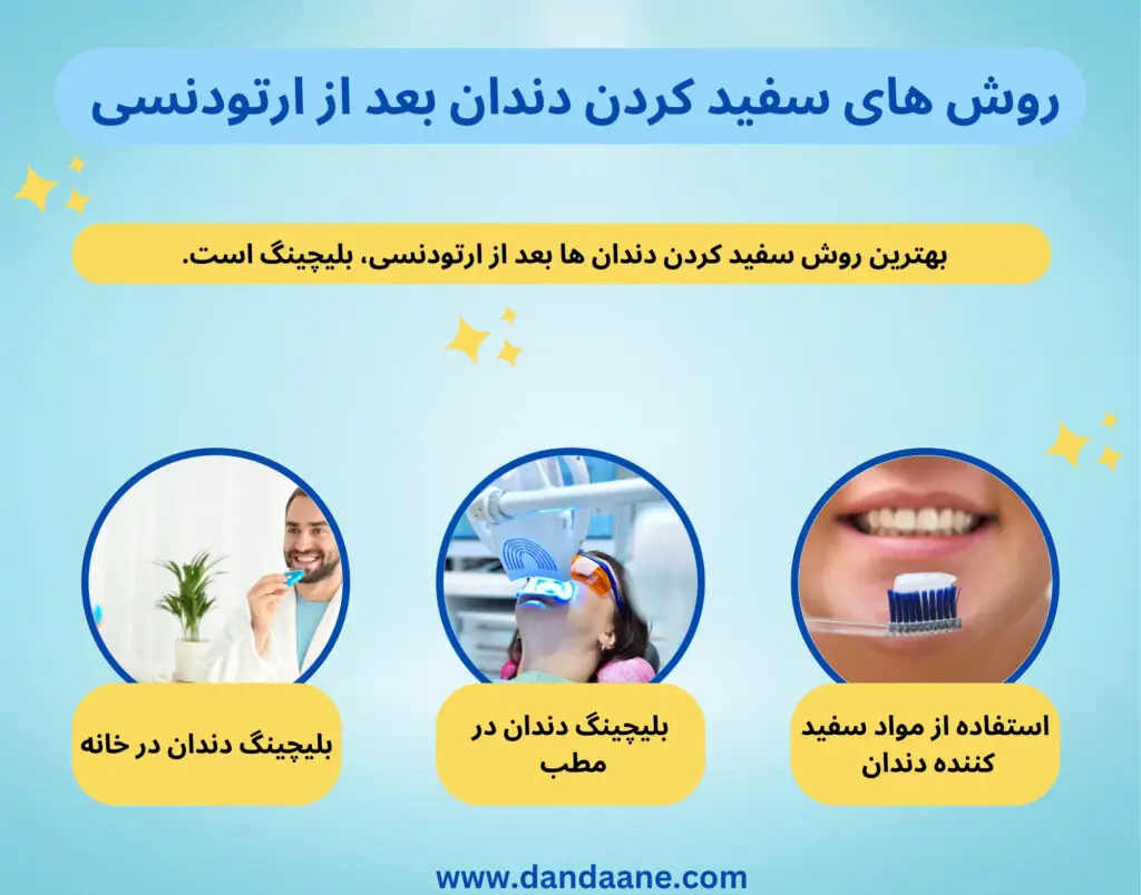 معرفی روش های مختلف سفید کردن دندان 