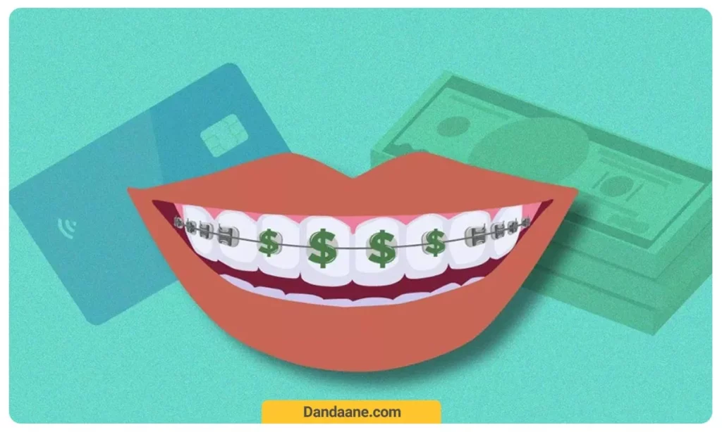به دلیل گران بودن ارتودنسی دیمون امکان پرداخت اقساطی از طرف برخی متخصصین امکان پذیر است.