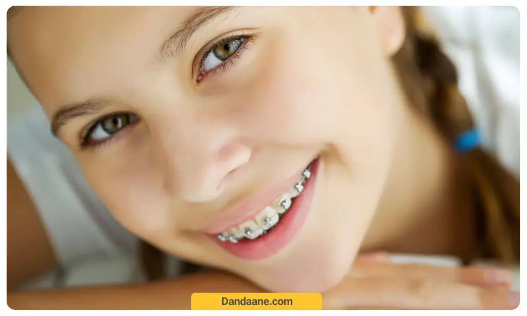 بهترین سن ارتودنسی دندان 10 تا 14 و نهایتا 15 سالگی است.