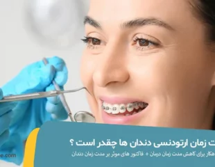 مدت زمان ارتودنسی چقدر است