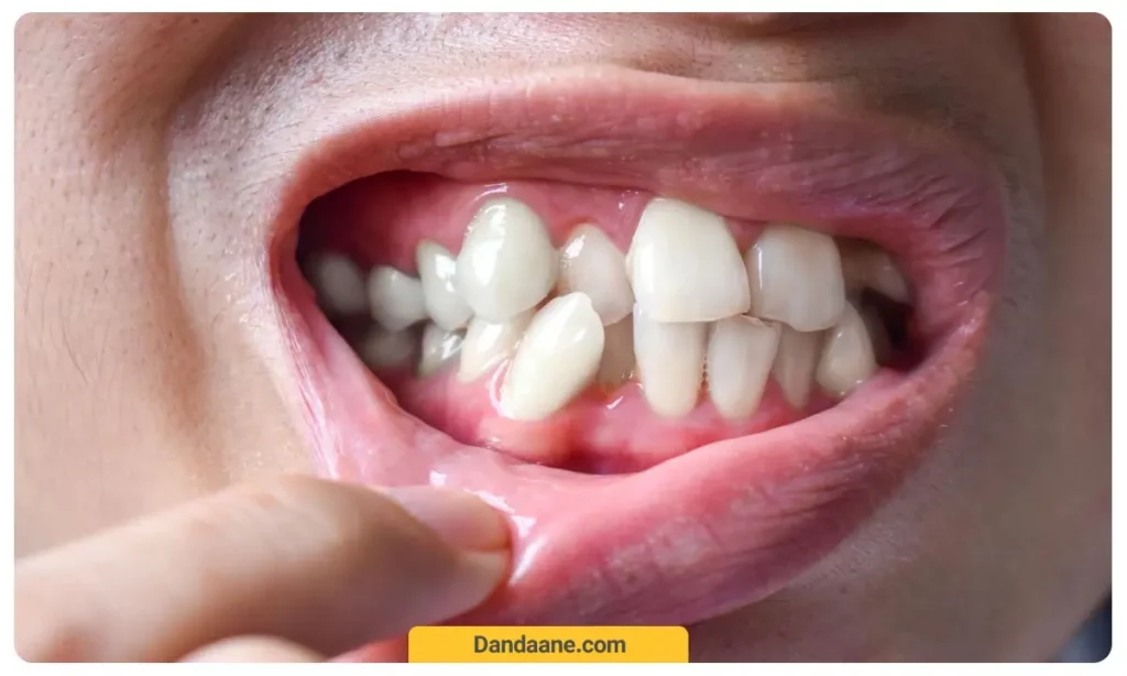 ناهنجاری های دندانی