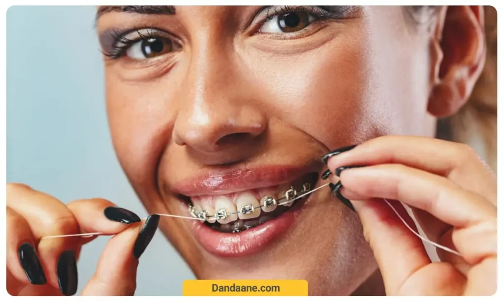 مراقبت از ارتودنسی دندان 