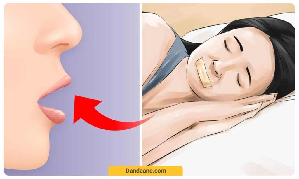 تنفس دهانی موجب تبخیر بزاق دهان شده و خشکی دهان اتفاق می افتد 